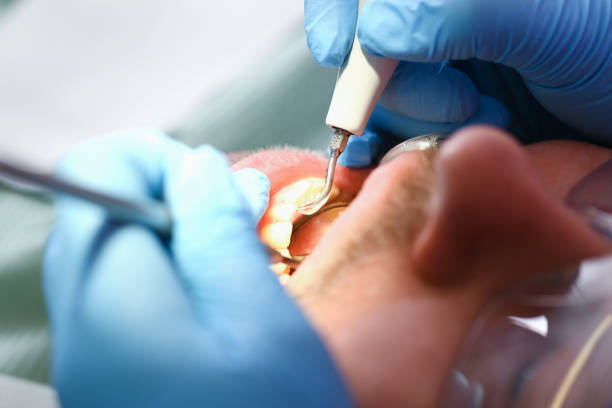 Best Emergency Dental Services for Seniors in Vernon Center, NJ